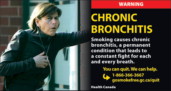Canada 2012  Health Effects lung - lived experience, chronic bronchitis - cigars eng